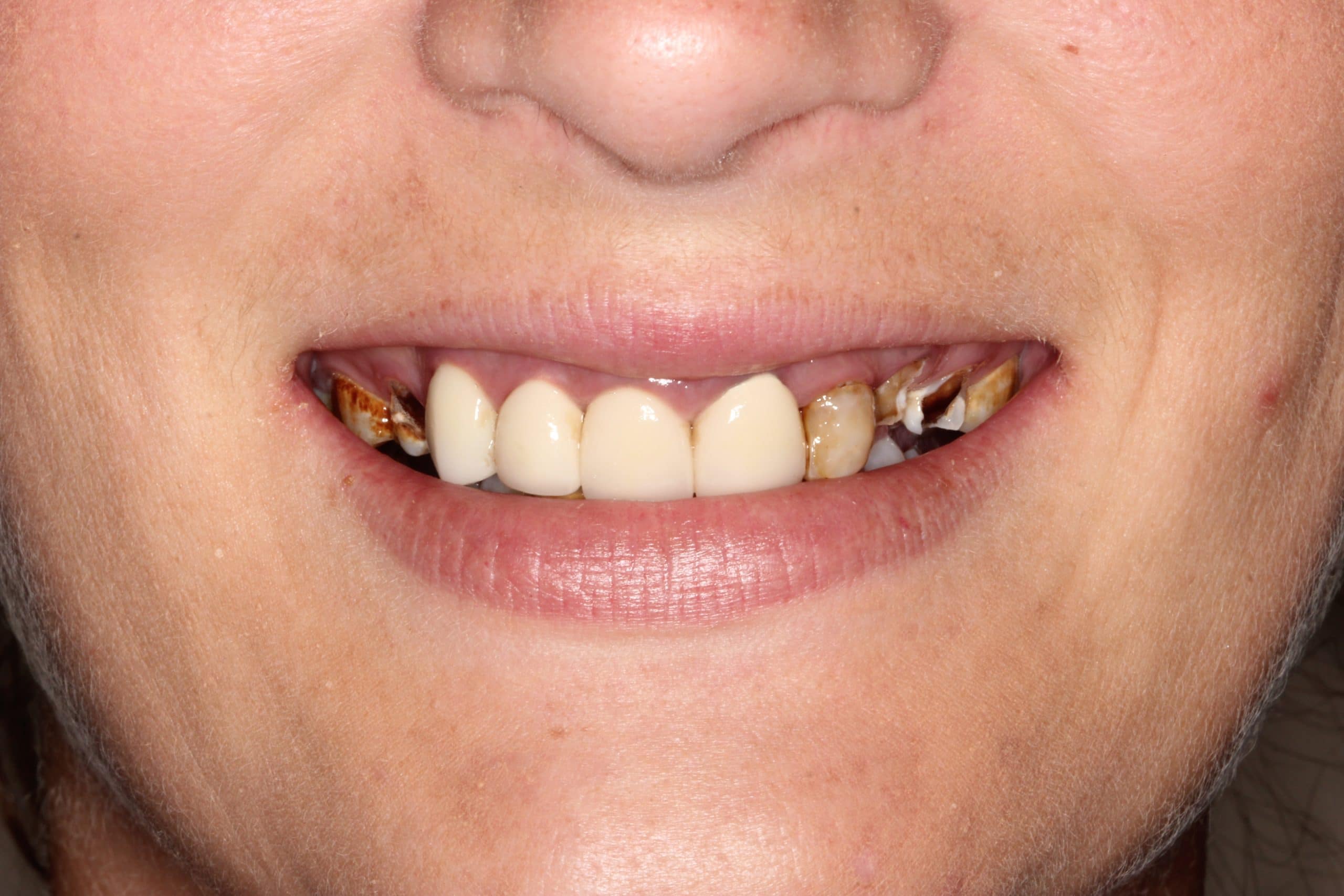 CosmeticDentistryB cosmetic dentistry before