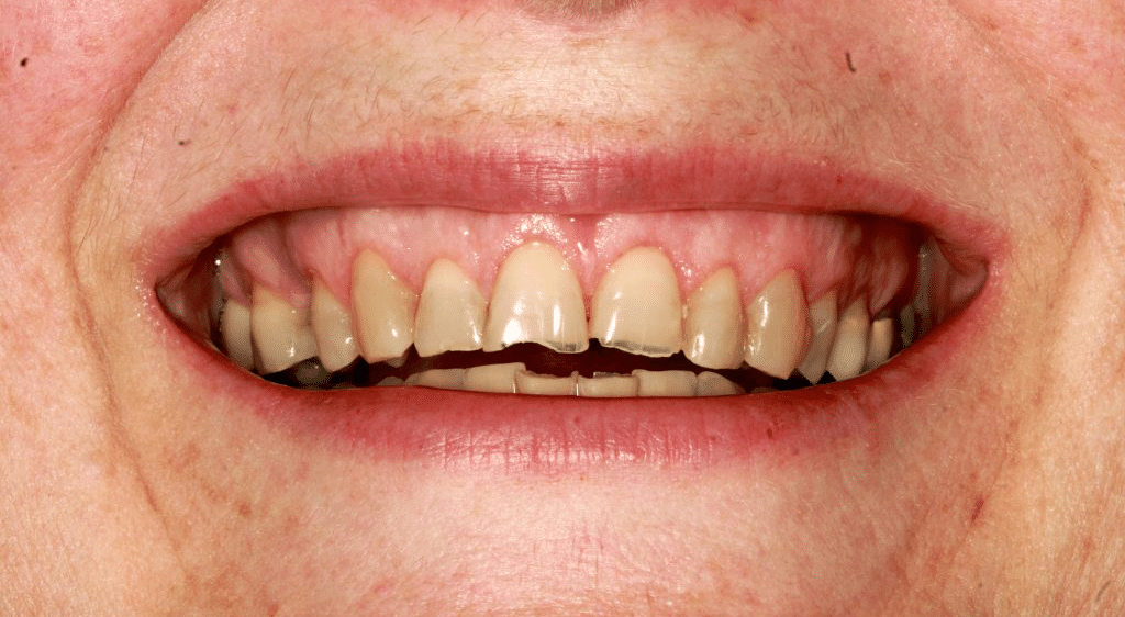 lori-before-smile-1024x562