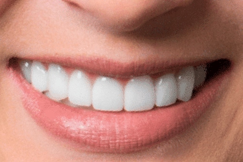 After Treatment