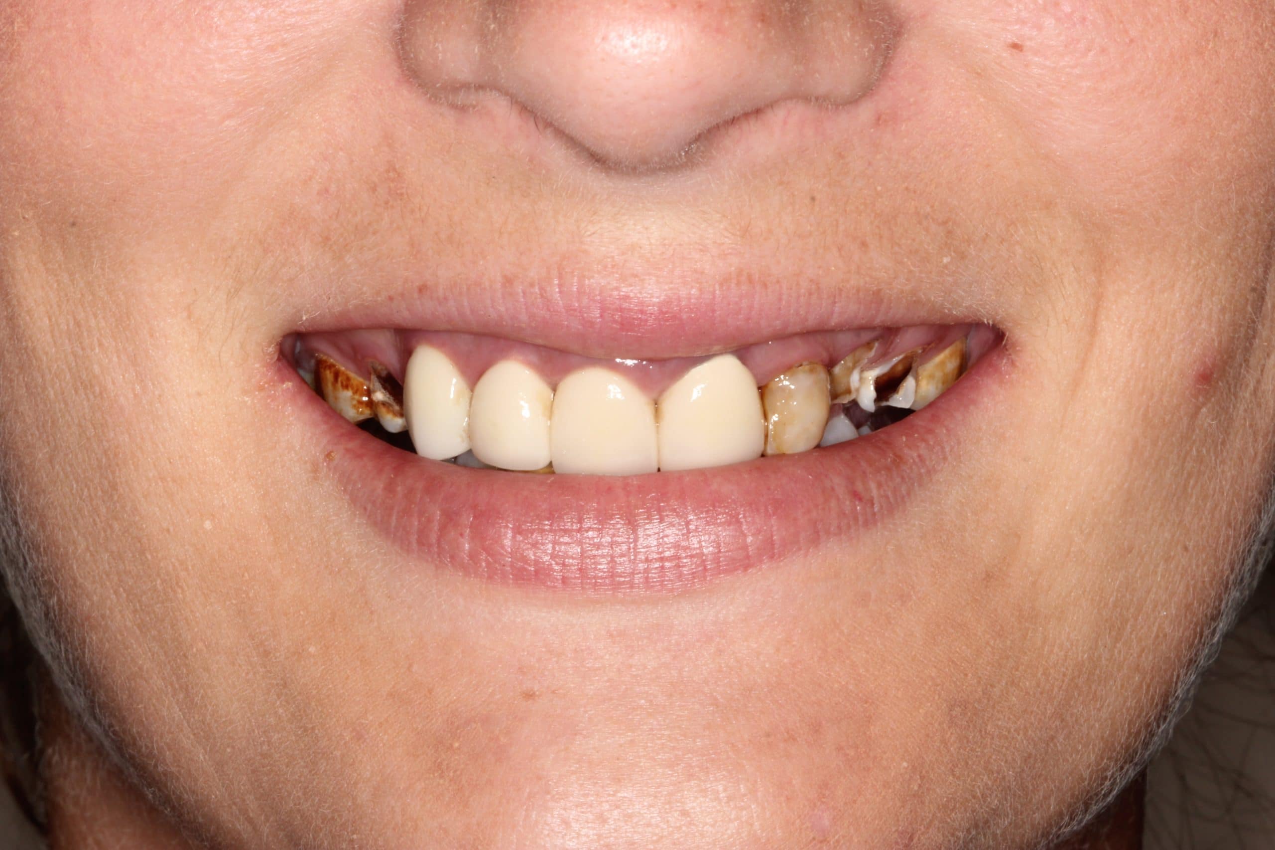 cosmetic dentistry before